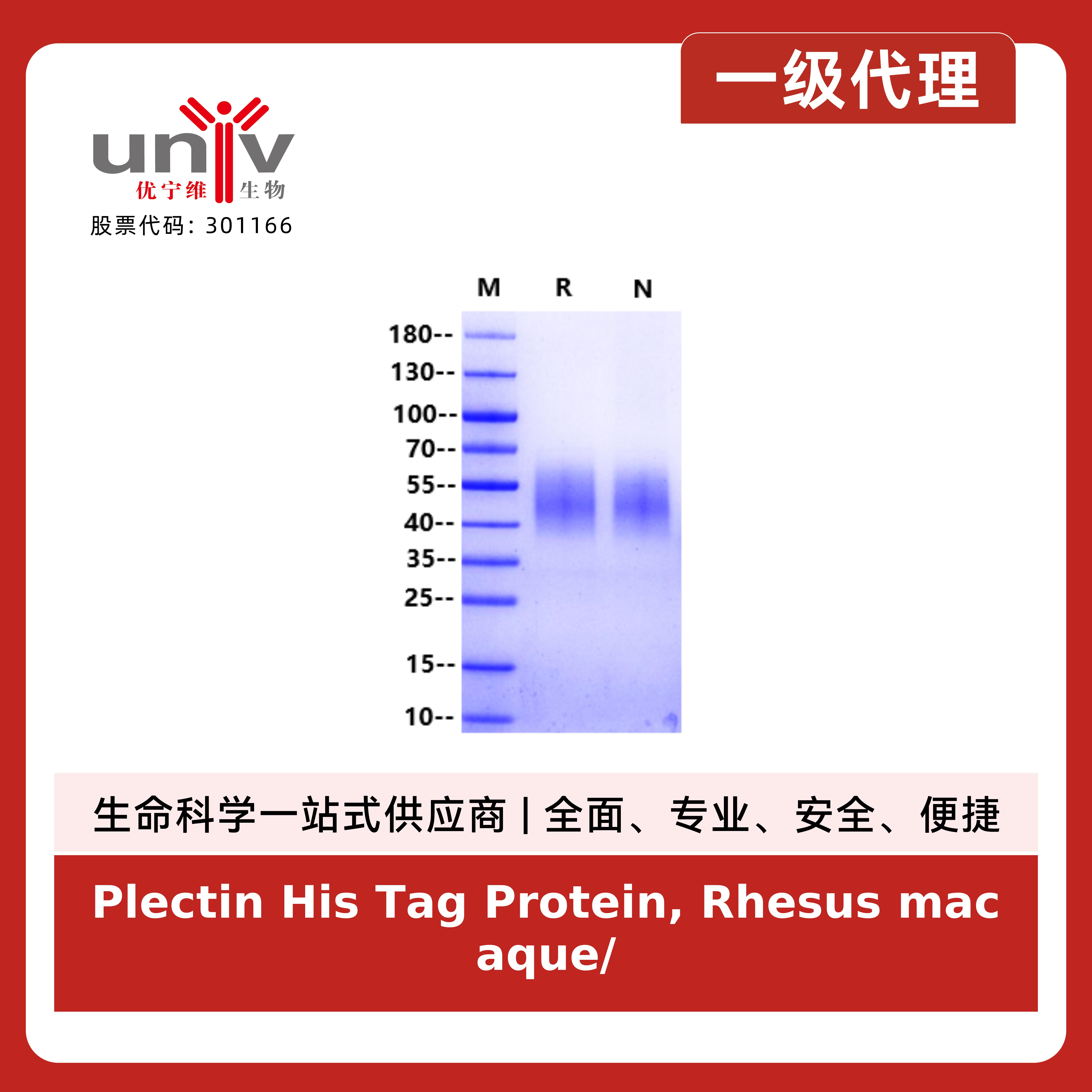 Plectin His Tag Protein, Rhesus macaque/Cynomolgus产品图