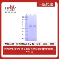 HRSVB(Strain 18537）Nucleoprotein ,His tag Protein