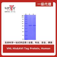 VHL His&AVI Tag Protein, Human