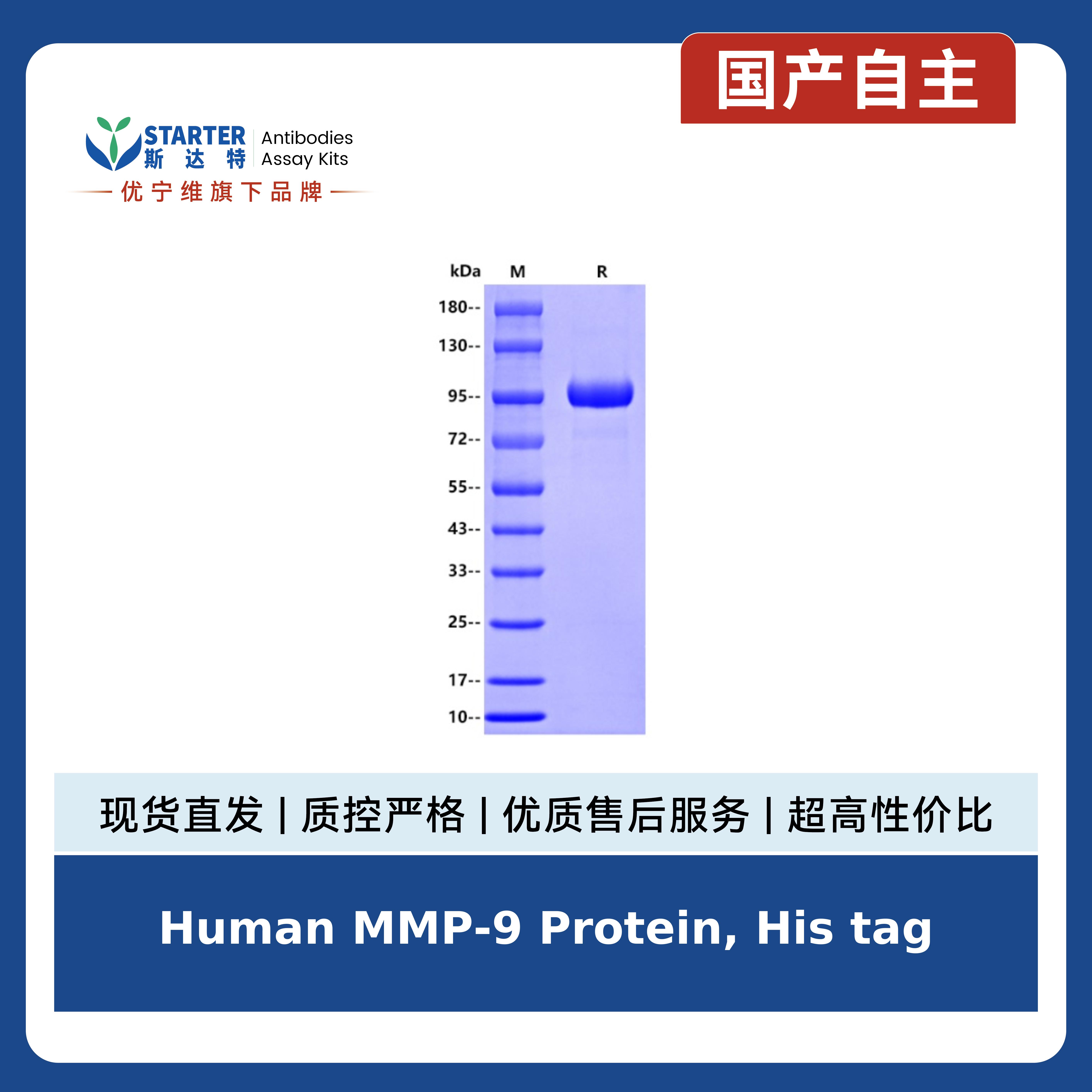 Human MMP-9 Protein, His tag产品图
