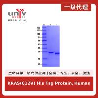 KRAS(G12V) His Tag Protein, Human