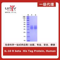 IL-10 R beta His Tag Protein, Human