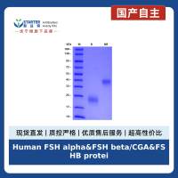 Human FSH alpha&FSH beta/CGA&FSHB protein, No tag&His tag