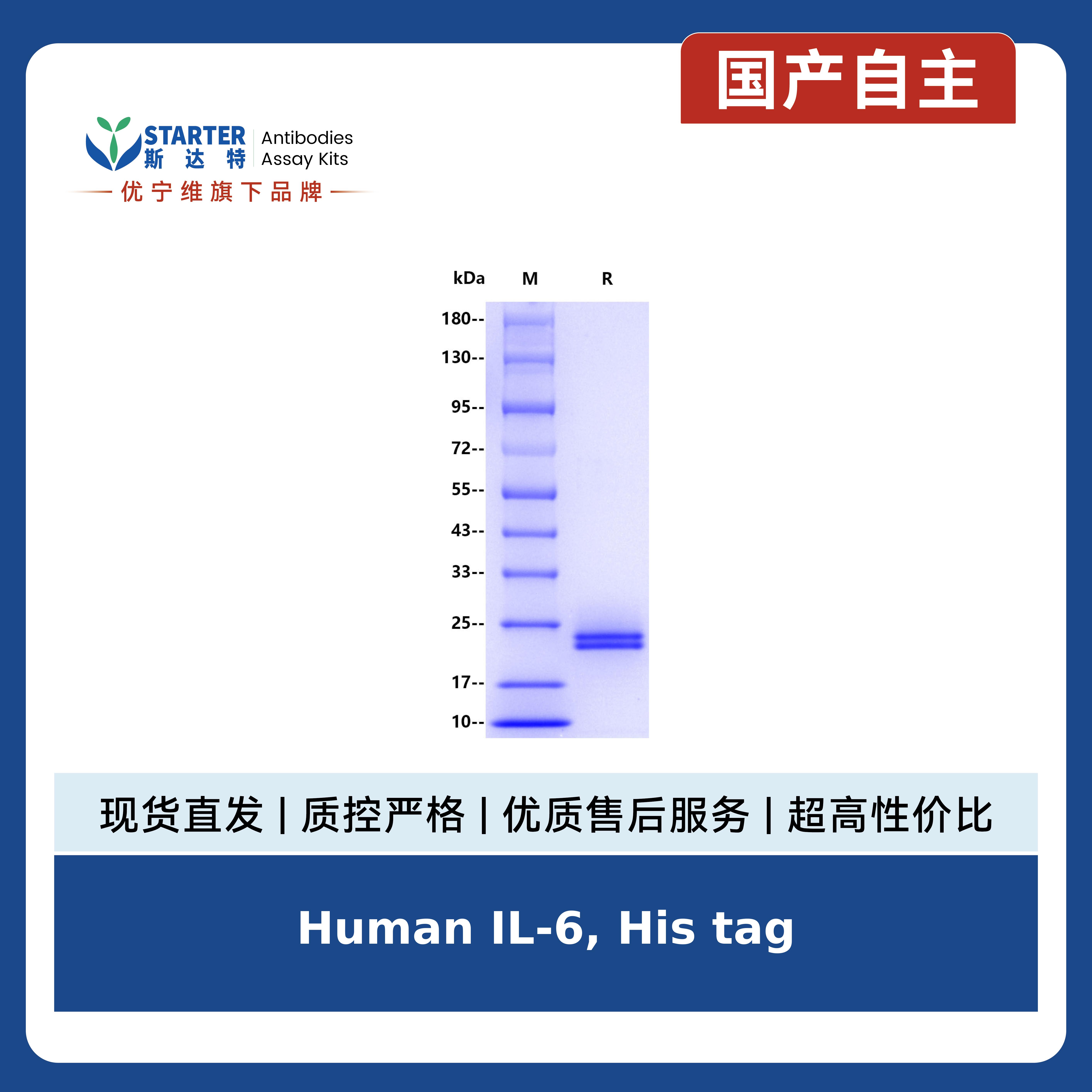 Human IL-6, His tag产品图