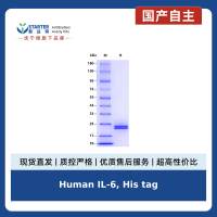 Human IL-6, His tag