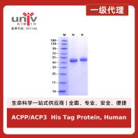 ACPP/ACP3  His Tag Protein, Human