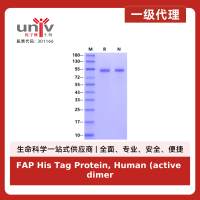 FAP His Tag Protein, Human (active dimer)