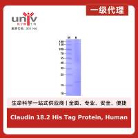 Claudin 18.2 His Tag Protein, Human