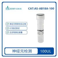 Recombinant anti Npas4 Rabbit Mab 重组Npas4单抗