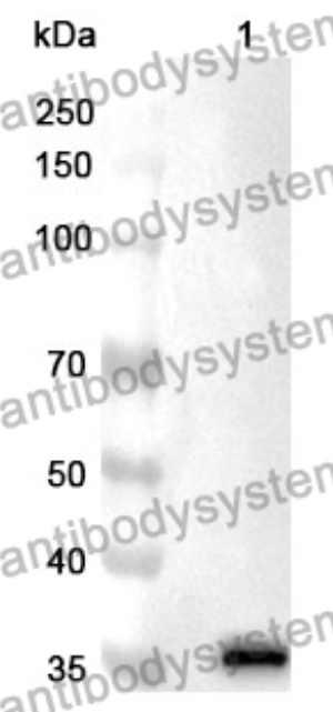 AntibodySystem蛋白抗体 | Anti-FN1 Polyclonal Antibody 抗纤连蛋白1多克隆抗体 · 兔源 · 抗原亲和纯化