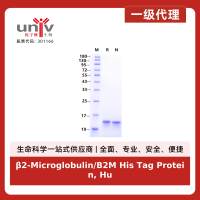 β2-Microglobulin/B2M His Tag Protein, Human