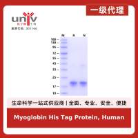 Myoglobin His Tag Protein, Human