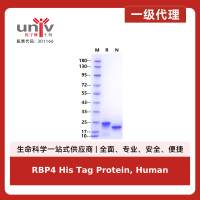 RBP4 His Tag Protein, Human