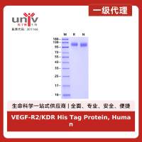 VEGF-R2/KDR His Tag Protein, Human