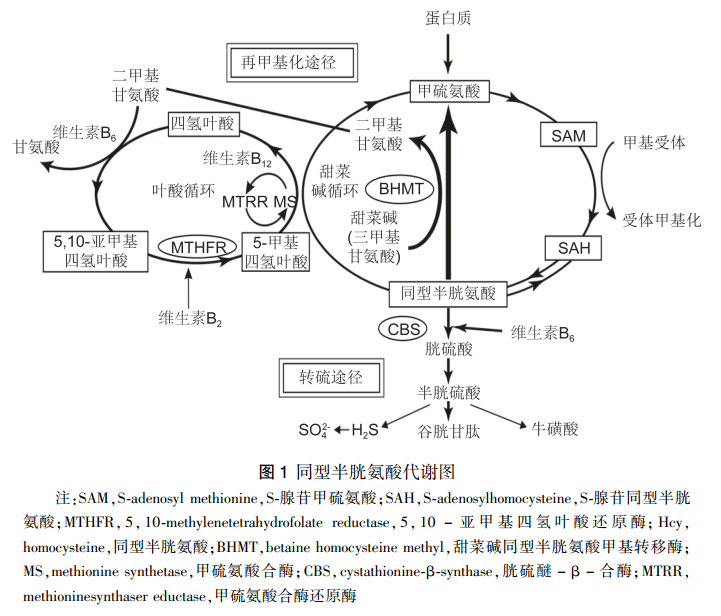 【专家共识】高同型半胱氨酸血症诊疗专家共识