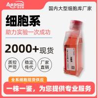 PG-EBV细胞(人B淋巴母细胞样细胞)