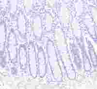 S-RMab® CD23 Recombinant Rabbit mAb,PBS Only (SDT-028-67)