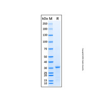 Recombinant Human C4 Protein，无载体, His标签, ≥85%(SDS-PAGE), 见COA，阿拉丁