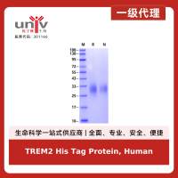 TREM2 His Tag Protein, Human