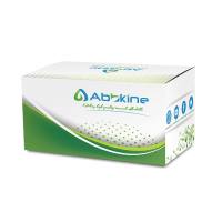 CheKine™ 丙氨酸氨基转移酶（谷丙转氨酶/ALT/GPT）活性检测试剂盒（IFCC 速率法）