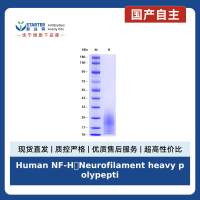 Human NF-H(Neurofilament heavy polypeptide) , His tag