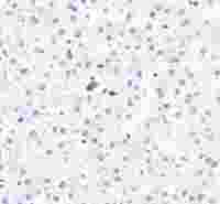 S-RMab® S100P Recombinant Rabbit mAb,PBS Only (SDT-070-44)