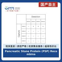 Pancreatic Stone Protein (PSP) Recombinant Rabbit mAb (SDT-3202-18)