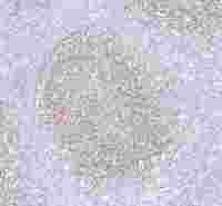 p75 NGF Receptor Recombinant Rabbit mAb(SDT-055-42)