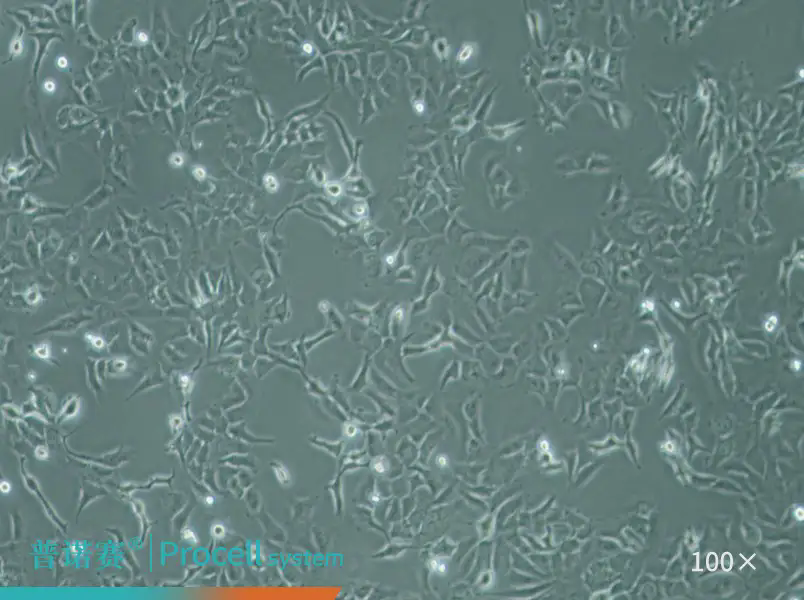 卵巢癌研究选对细胞，实验事半功倍——普诺赛SK-OV-3（人卵巢癌细胞）全新供应