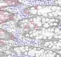 S-RMab® EpCAM Recombinant Rabbit mAb(SDT-078-13)