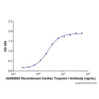 Recombinant Human Cardiac Troponin I/cTnI Protein ,无载体, 生物活性, ActiBioPure™, ≥90%(SDS-PAGE), expressed in E. coli; 见COA,阿拉丁