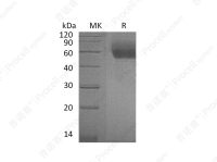 IL-1RL1/IL-1 R4 (C-6His), Mouse, Recombinant