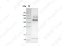 TGFβ 1/TGFB1, Human, Recombinant