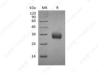 RANK/TNFRSF11A/CD265 (C-6His), Mouse, Recombinant
