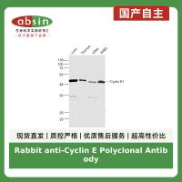 Rabbit anti-Cyclin E Polyclonal Antibody
