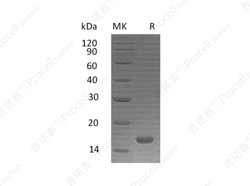 IL-21/Za11, Human, Recombinant产品图