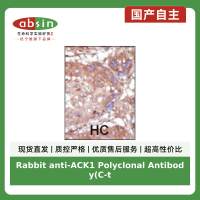 Rabbit anti-ACK1 Polyclonal Antibody(C-term)