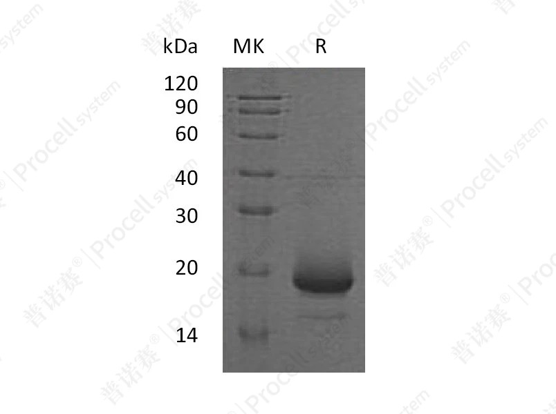 IL-4/BSF-1 (C-6His), Human, Recombinant产品图