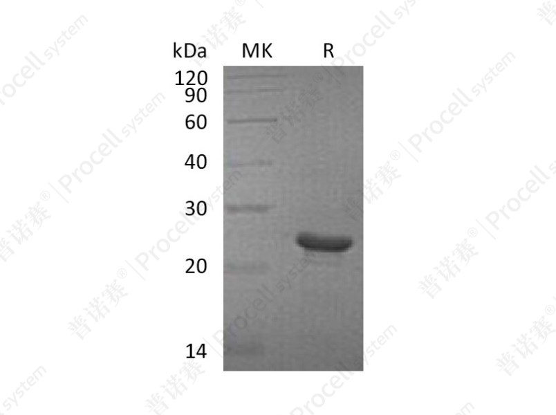 FGF-21/FGFL, Human, Recombinant产品图
