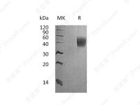 IL-4Ra (C-6His), Cynomolgus, Recombinant