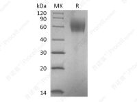 IL-23R (C-6His), Human, Recombinant