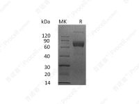IL-4Rα/CD124 (C-mFc), Human, Recombinant
