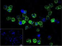 Rabbit anti-TNF α Polyclonal Antibody