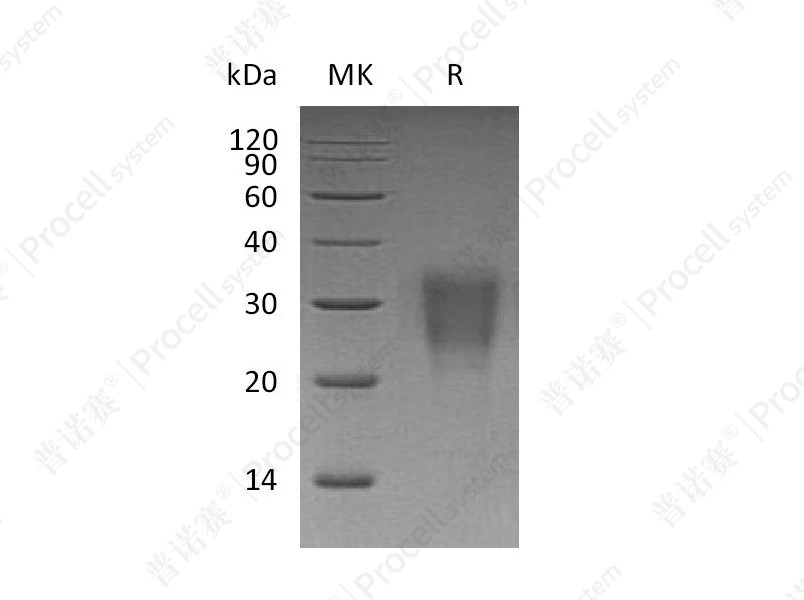 IL-22 (C-hIgG2 Fc), Human, Recombinant产品图