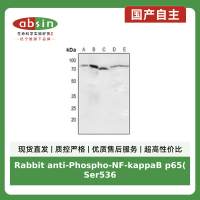Rabbit anti-Phospho-NF-kappaB p65(Ser536) Polyclonal Antibody
