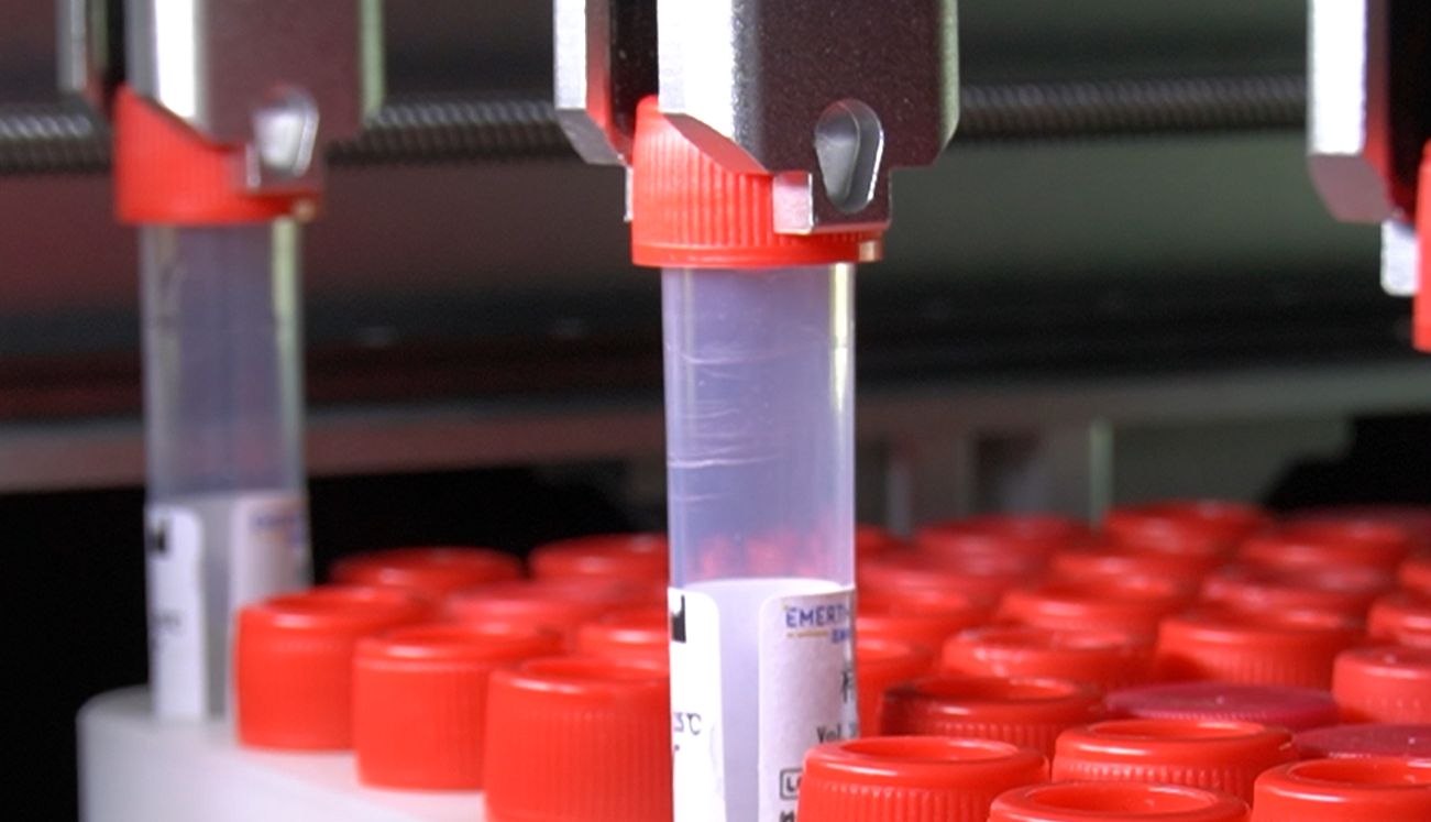 磁珠法提取+唾液保存液：常温长期存储核酸，精准提取高纯度DNA