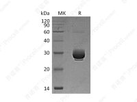 ANGPTL3 (Ser17-Thr206) (C-6His), Mouse, Recombinant