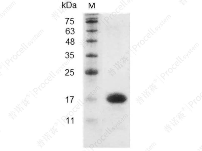 IL-16/LCF, Mouse, Recombinant产品图