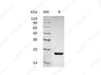 IL-1RA/ICIL-1RA/IRAP/IL-1RN, Human, Recombinant