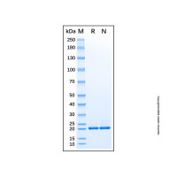 Recombinant Human RPL26 Protein,无载体, His标签, ≥95%(SDS-PAGE), 见COA,阿拉丁